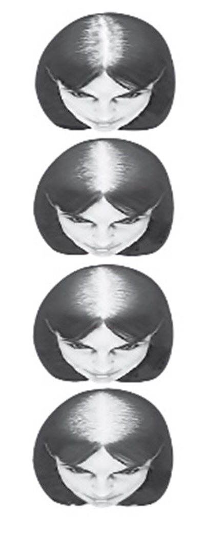 Vertex (03 22 17 129 Vertex Image)